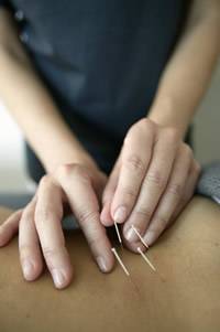 Shaftesbury Acupuncture Clinic 722085 Image 2